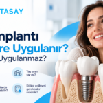 Diş implantı ve çene kemiği üzerinde implant uygulamasını gösteren illüstrasyon — Dentasay Mardin diş implantı kimlere uygulanır yazısı görseli.