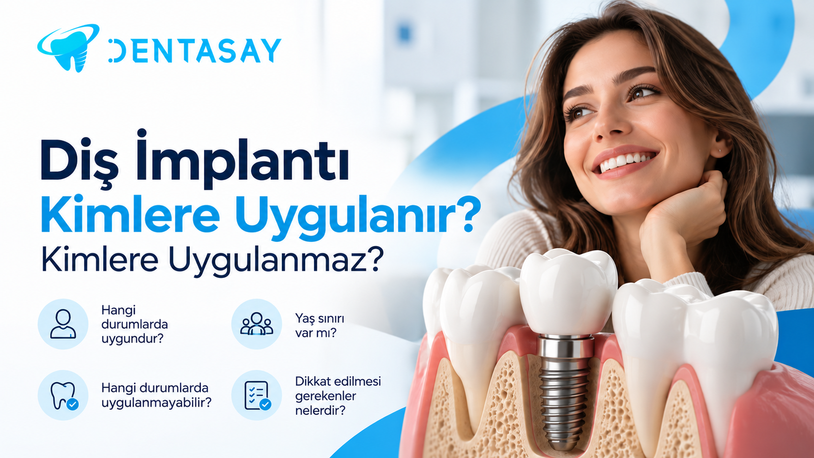 Diş implantı ve çene kemiği üzerinde implant uygulamasını gösteren illüstrasyon — Dentasay Mardin diş implantı kimlere uygulanır yazısı görseli.
