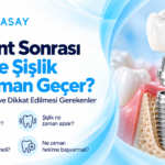 İmplant tedavisi sonrası ağrı ve şişlik belirtilerini gösteren illüstrasyon — Dentasay Mardin implant sonrası ağrı ve şişlik yazısı görseli.