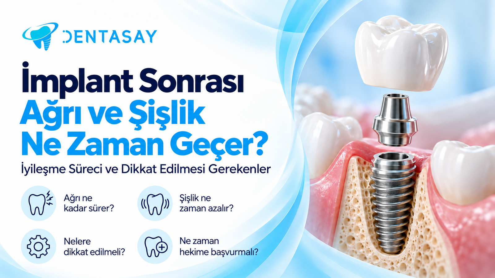 İmplant tedavisi sonrası ağrı ve şişlik belirtilerini gösteren illüstrasyon — Dentasay Mardin implant sonrası ağrı ve şişlik yazısı görseli.