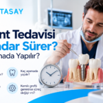 İmplant tedavi sürecinin aşamalarını gösteren illüstrasyon — Dentasay Mardin implant tedavisi ne kadar sürer yazısı görseli.