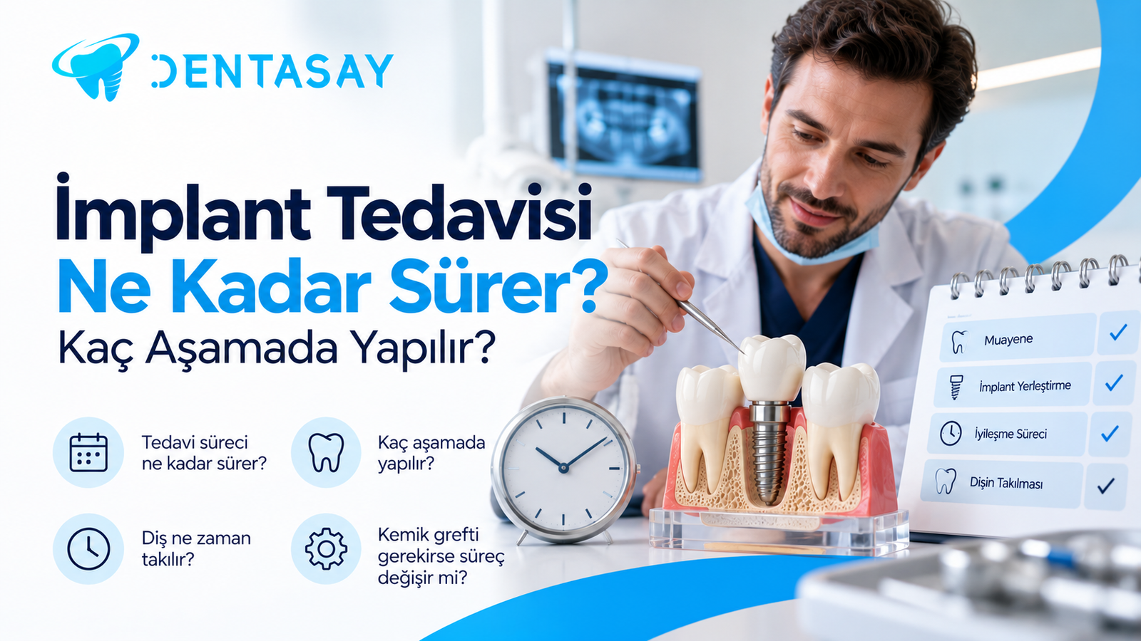 İmplant tedavi sürecinin aşamalarını gösteren illüstrasyon — Dentasay Mardin implant tedavisi ne kadar sürer yazısı görseli.