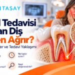 Kanal tedavisi yapılmış dişte ağrı bölgesini gösteren illüstrasyon — Dentasay Mardin kanal tedavisi yapılan diş neden ağrır yazısı görseli.
