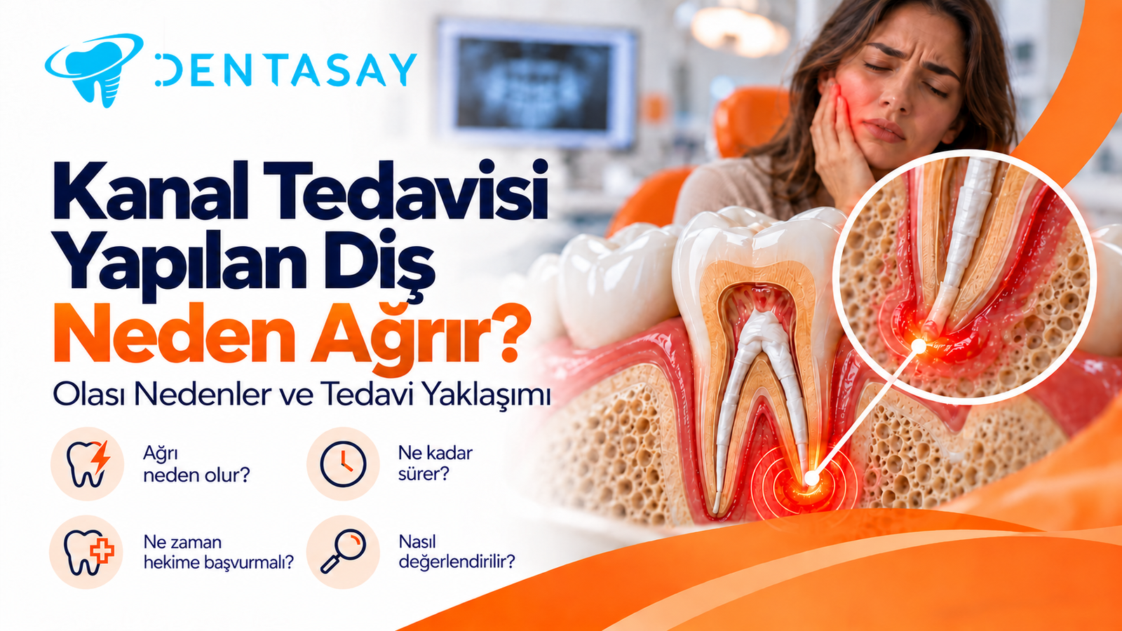 Kanal tedavisi yapılmış dişte ağrı bölgesini gösteren illüstrasyon — Dentasay Mardin kanal tedavisi yapılan diş neden ağrır yazısı görseli.